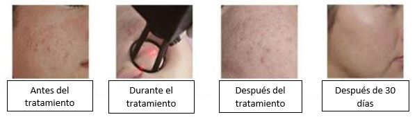 imec
