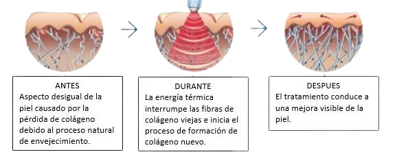 imec